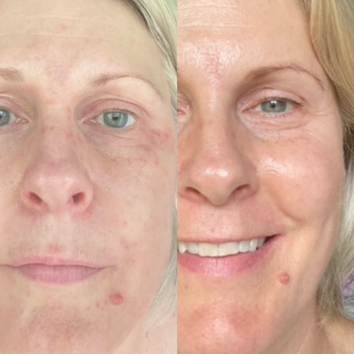 Sea Cucumber Collagen Day & Night Pack