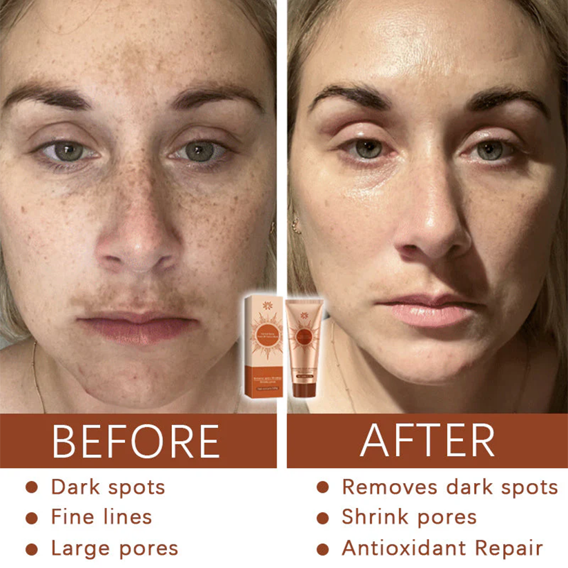 Herbal Spots Peel-Off Facial Mask