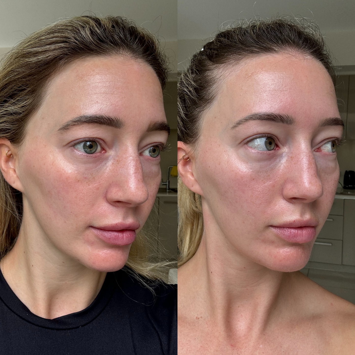 Sea Cucumber Collagen Day & Night Pack