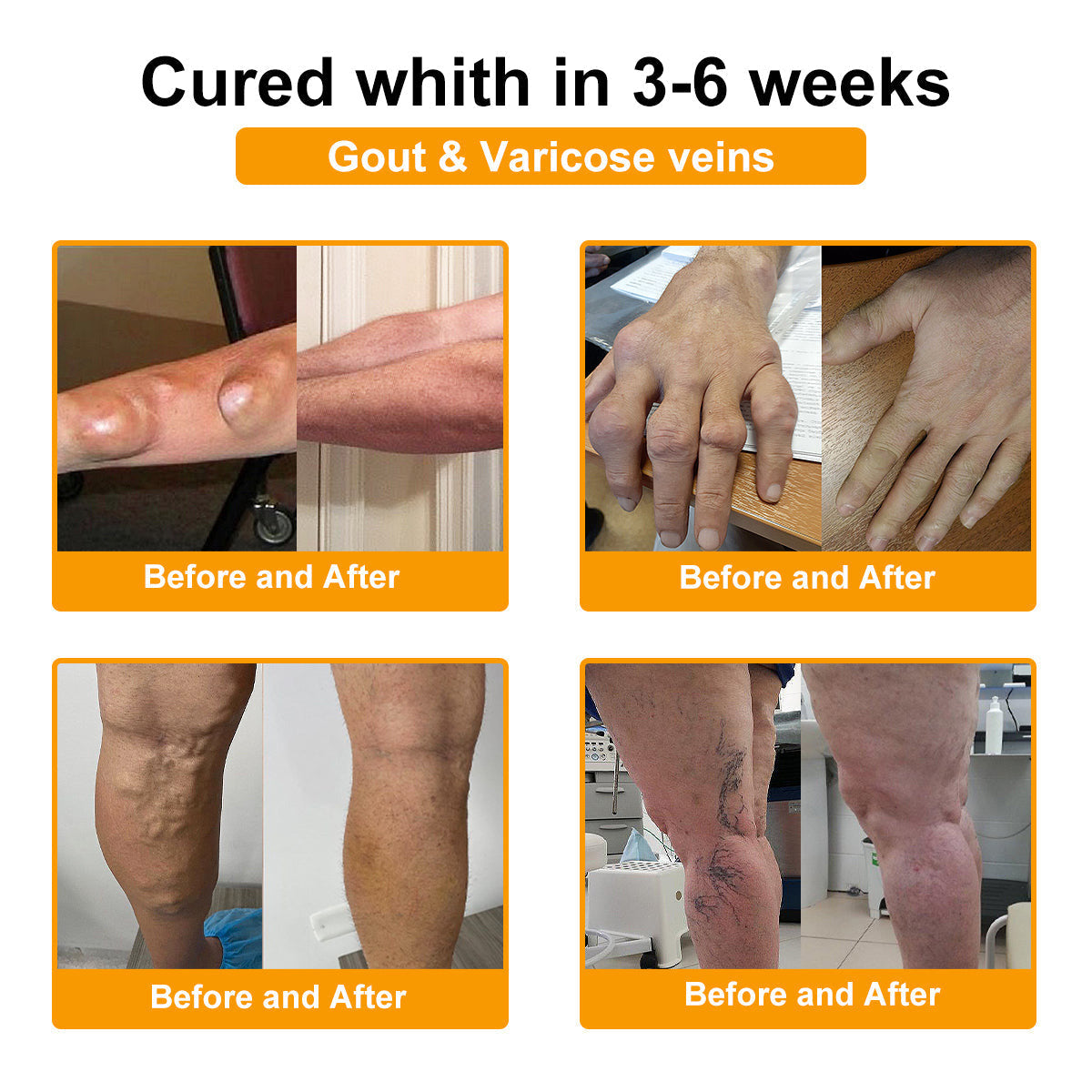 Bee Venom Pain-Relief Bone Healing Cream