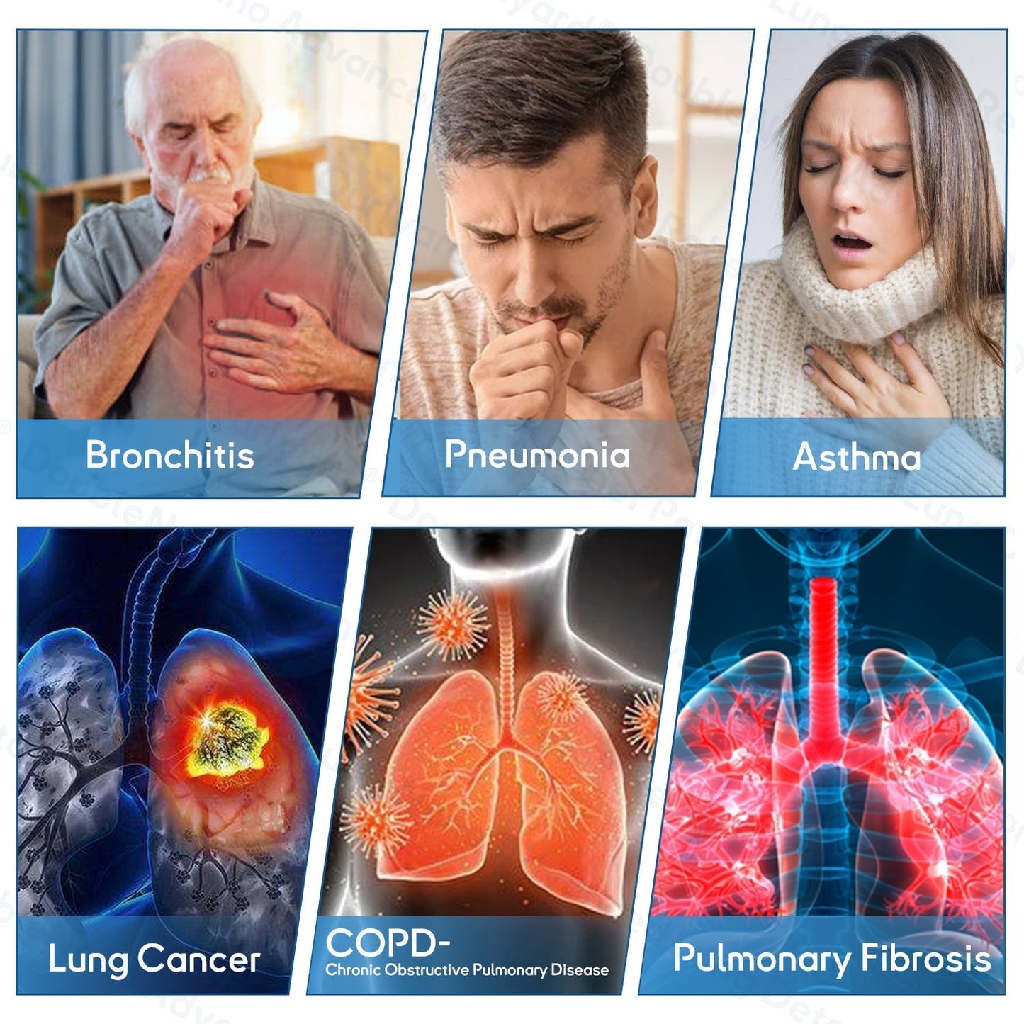 FDA Approved|Lamray® Double Nano Copd Relief Patch ( Cough, Wheezing, Shortness Of Breath, Sputum, Stuffy Nose, Bronchitis, Bronchitis, Allergy Symptoms, Lung Discomfort🫁)