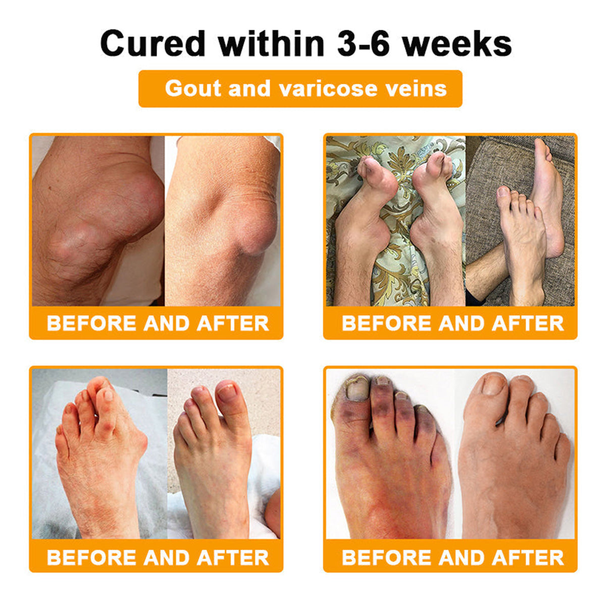 Bee Venom Pain-Relief Bone Healing Cream