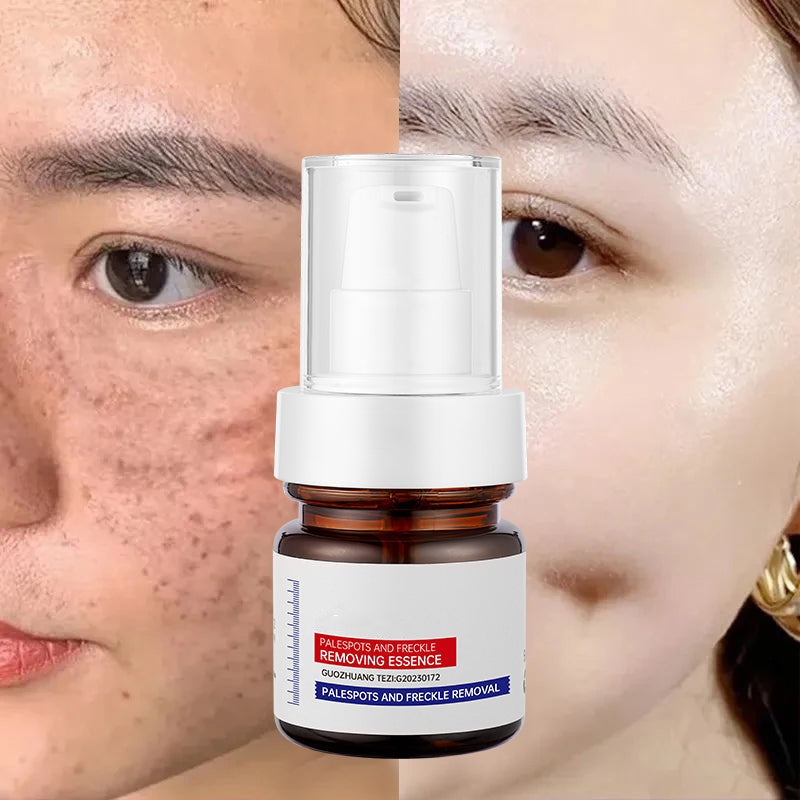 5-second brightening rescue: Dark spots disappear, blemishes fade, and skin becomes radiant! Vitamin C Whitening Freckles ESSENCE