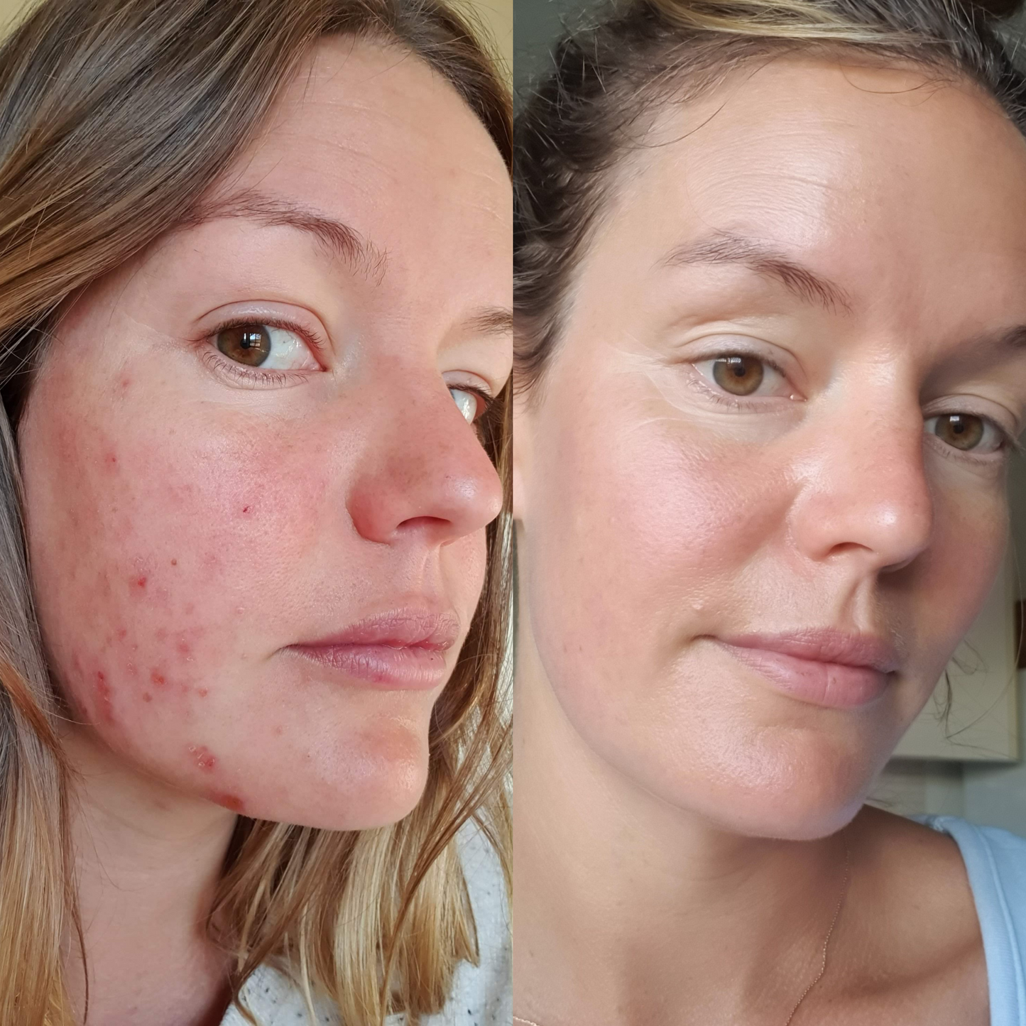 Sea Cucumber Collagen Day & Night Pack