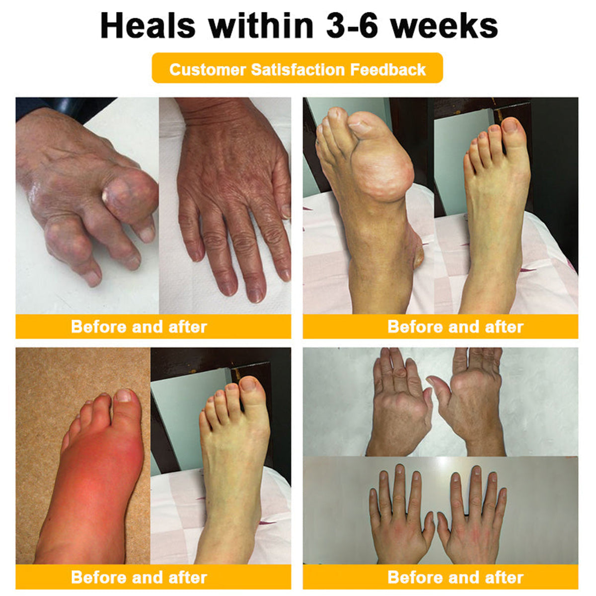 Bee Venom Pain-Relief Bone Healing Cream
