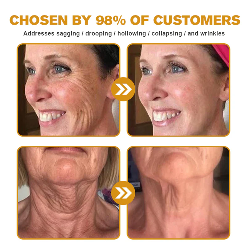 Bee venom Pro Comprehensive Cream