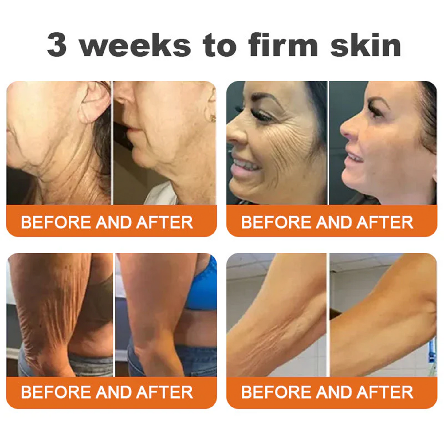 Bee venom Pro Comprehensive Cream