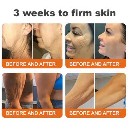 Bee venom Pro Comprehensive Cream
