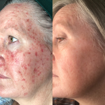 Sea Cucumber Collagen Day & Night Pack