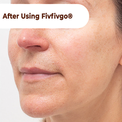 Herbal Spots Peel-Off Facial Mask