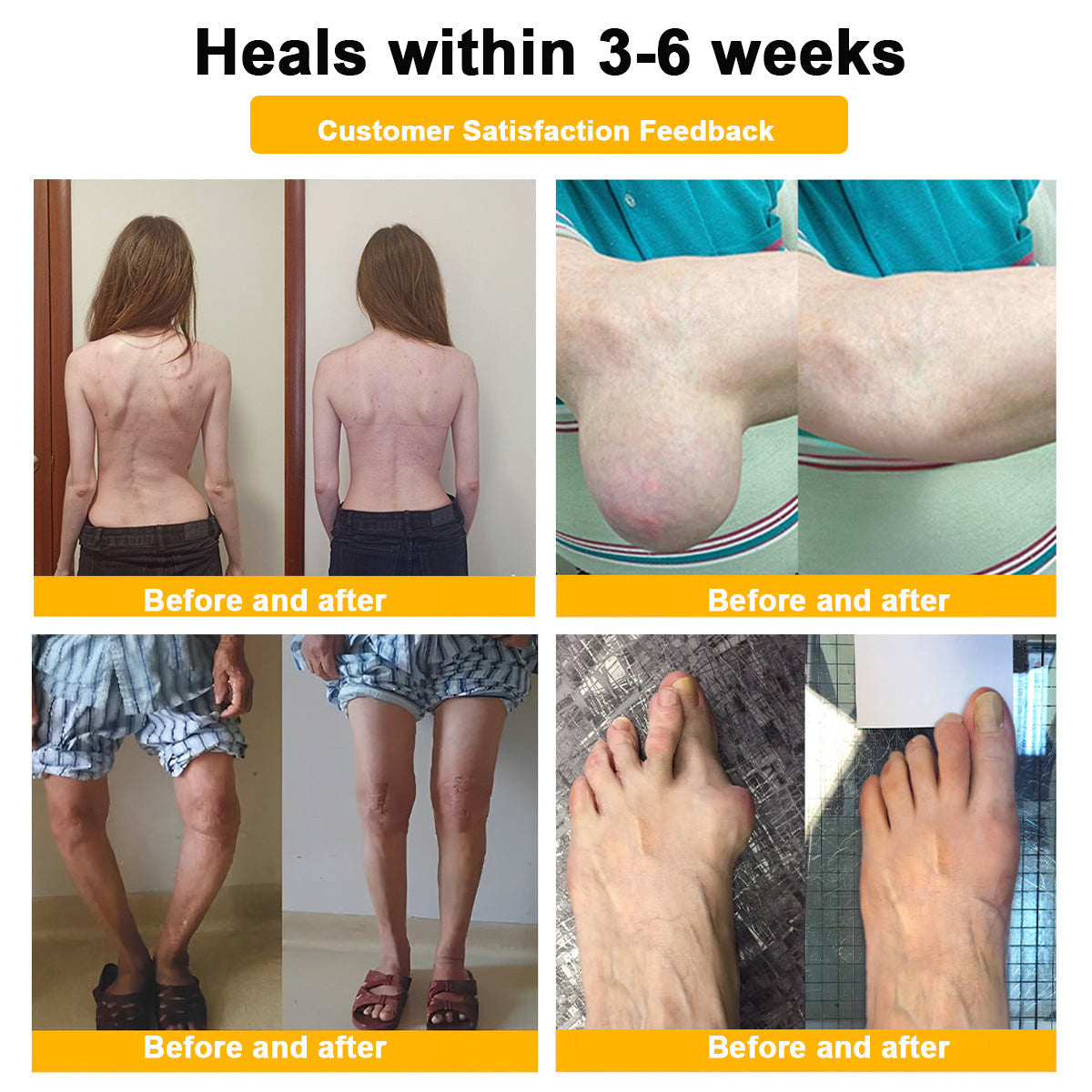 Bee Venom Pain-Relief Bone Healing Cream