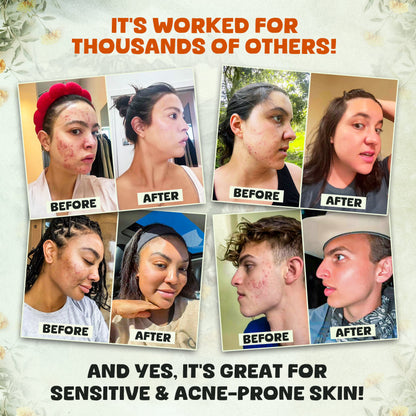 Honey Face Balm