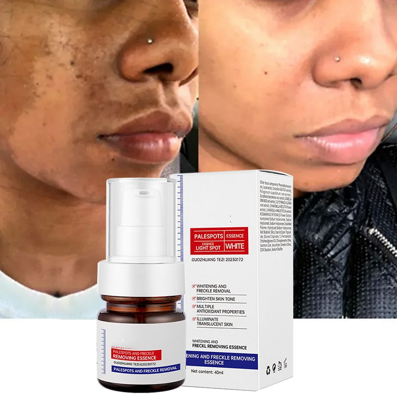 5-second brightening rescue: Dark spots disappear, blemishes fade, and skin becomes radiant! Vitamin C Whitening Freckles ESSENCE