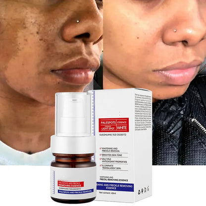 5-second brightening rescue: Dark spots disappear, blemishes fade, and skin becomes radiant! Vitamin C Whitening Freckles ESSENCE