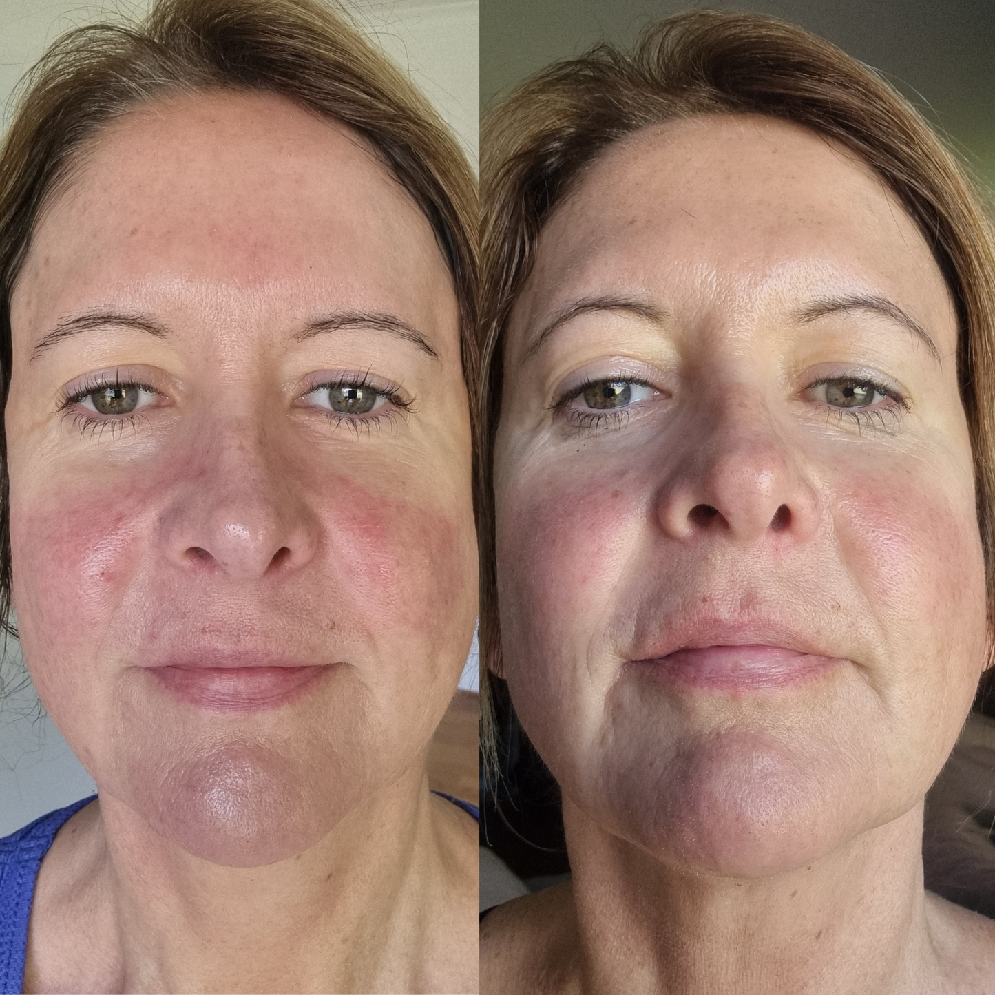 Sea Cucumber Collagen Day & Night Pack