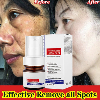 5-second brightening rescue: Dark spots disappear, blemishes fade, and skin becomes radiant! Vitamin C Whitening Freckles ESSENCE